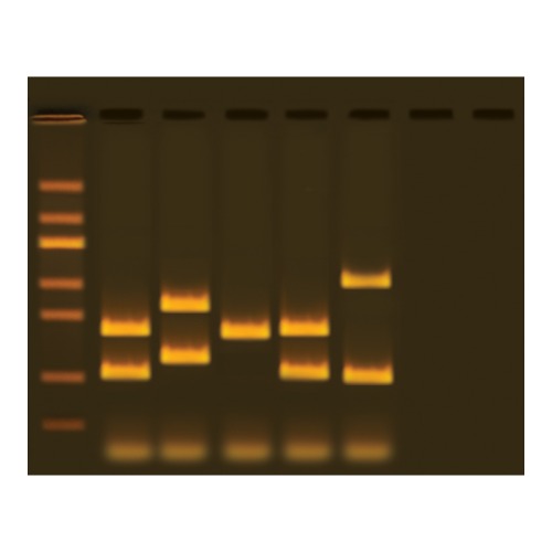 VNTR 인간 DNA 분류