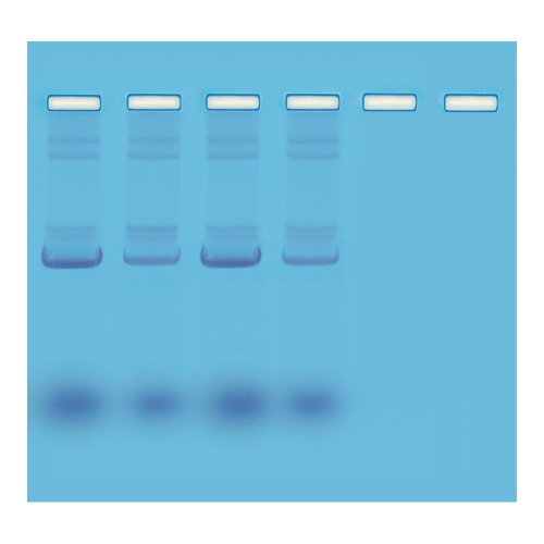 MINI-PREP을 이용한 플라스미드 DNA 분리