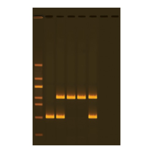Alu 인간 DNA 분석